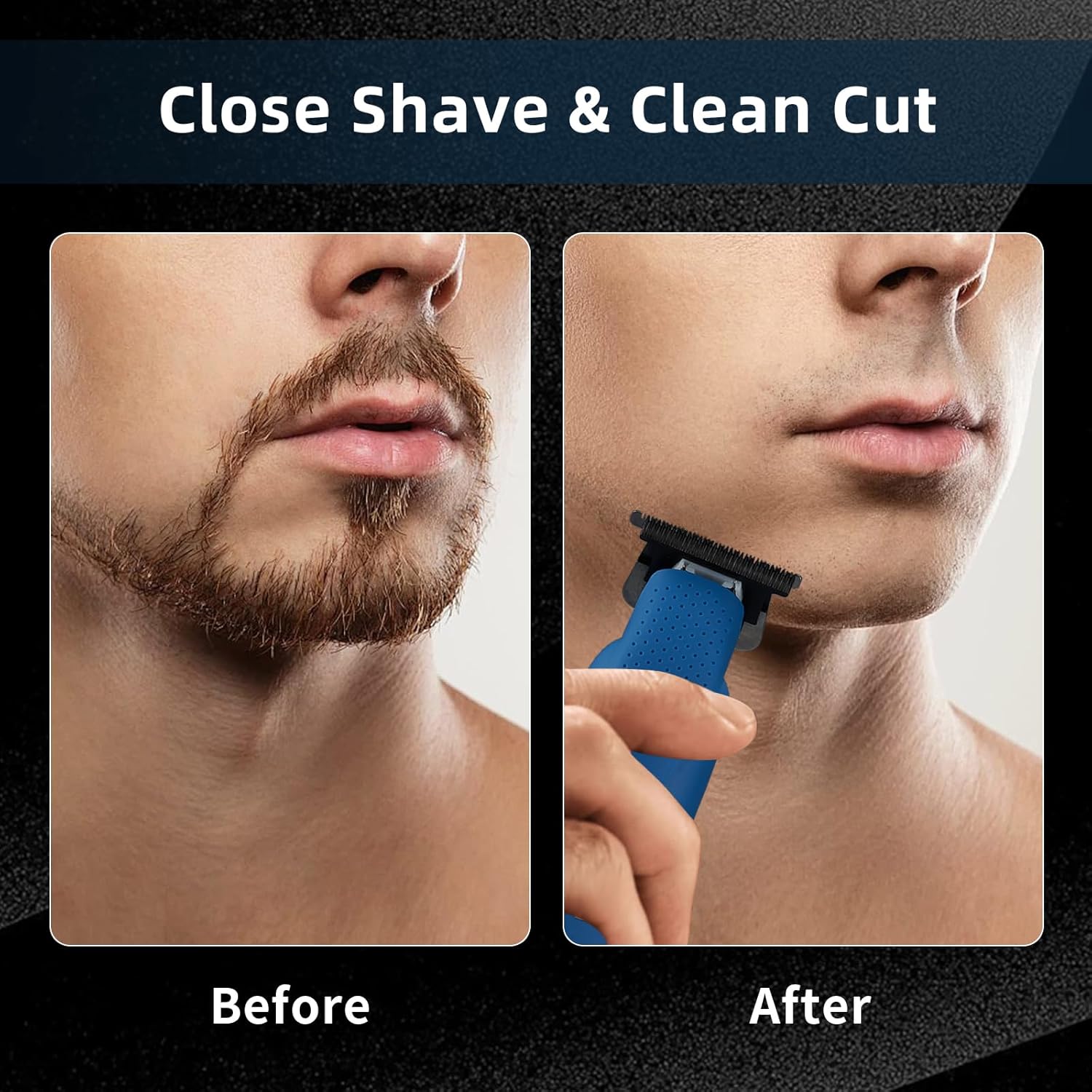 Beard Trimmer for Men, Zero Ga - đánh giá và giá Men'S Grooming Guide